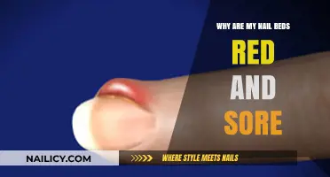 Red, Sore Nail Beds: Causes, Concerns, and Effective Remedies Explained