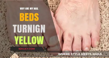 Yellow Nail Beds: Causes, Concerns, and Effective Solutions Explained