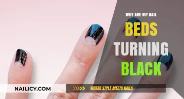 Black Nail Beds: Causes, Concerns, and When to Seek Help