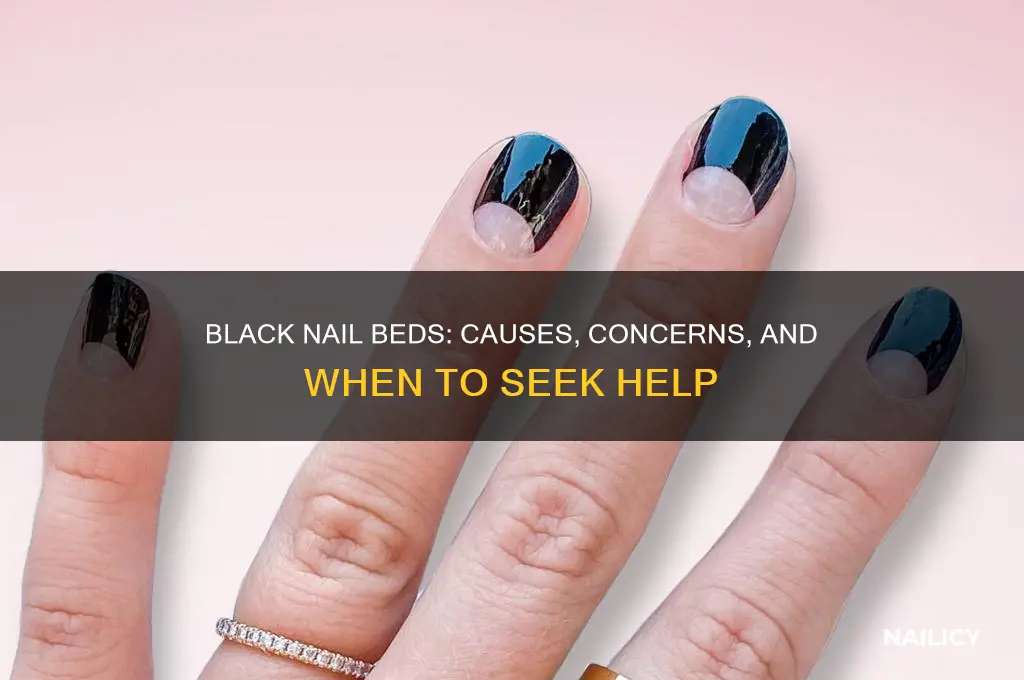 why are my nail beds turning black