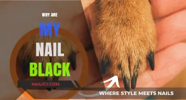 Why Are My Nails Black? Causes, Concerns, and Solutions Explained