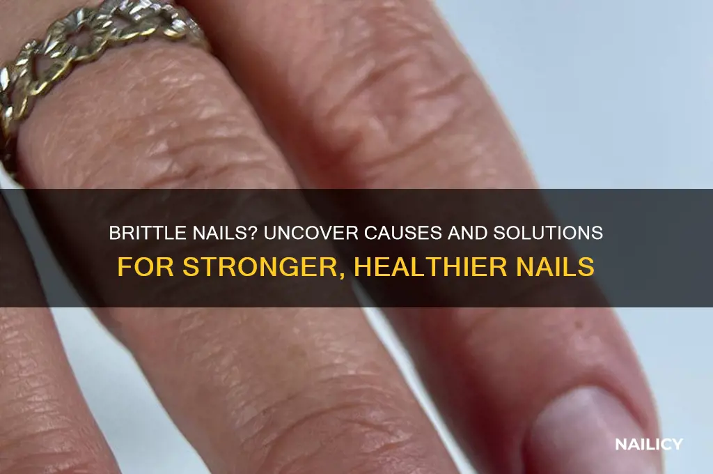why are my nail brittle