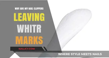 Why Nail Clippers Cause White Marks: Causes and Solutions Explained