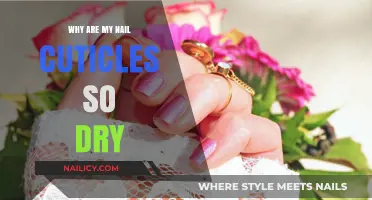 Dry Cuticles? Discover Causes and Solutions for Healthy Nails