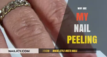 Why Are My Nails Peeling? Causes and Solutions Explained