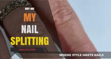 Why Are My Nails Splitting? Causes and Solutions for Brittle Nails