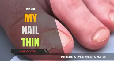 Why Are My Nails So Thin? Causes and Solutions Explained