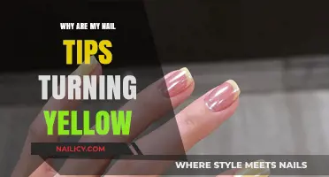 Yellow Nail Tips: Causes, Concerns, and Effective Solutions Explained