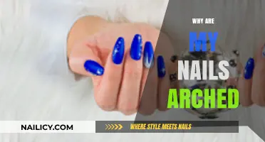 Why Are My Nails Arched? Understanding Nail Shape and Health