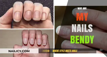 Why Are My Nails Bendy? Causes and Solutions for Weak Nails