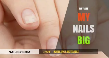 Why Are My Nails So Big? Understanding Causes and Solutions