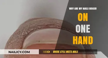 Uneven Nail Growth: Why One Hand's Nails Appear Larger Than the Other