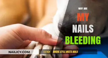 Why Are My Nails Bleeding? Causes, Concerns, and Solutions Explained