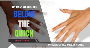 Why Are My Nails Breaking Below the Quick? Causes & Solutions