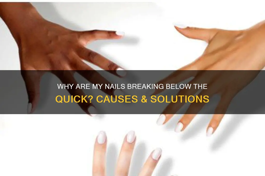 why are my nails breaking below the quick