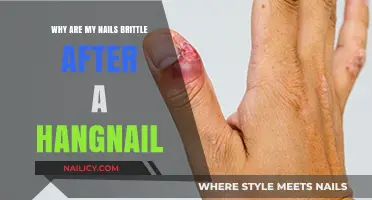Brittle Nails After Hangnail: Causes, Prevention, and Effective Remedies