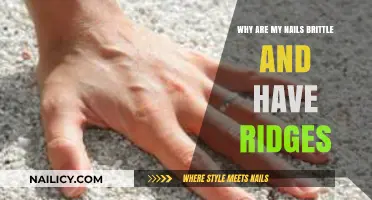 Brittle Nails and Ridges: Causes, Solutions, and Healthy Nail Care Tips
