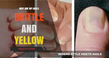 Brittle and Yellow Nails: Causes, Solutions, and Healthy Nail Care Tips