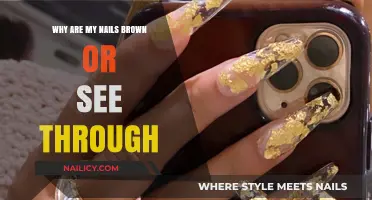 Brown or See-Through Nails: Causes, Concerns, and Solutions Explained
