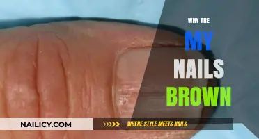 Why Are My Nails Brown? Causes, Concerns, and Solutions Explained