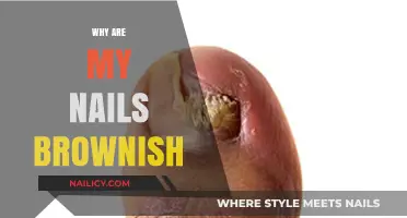 Why Are My Nails Brownish? Causes and Solutions Explained