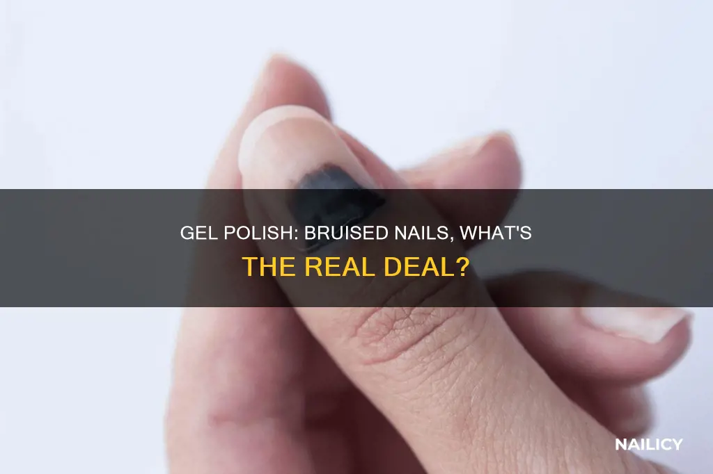 why are my nails bruised after gel polish