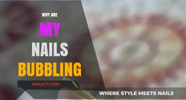 Why Are My Nails Bubbling? Causes and Solutions Explained