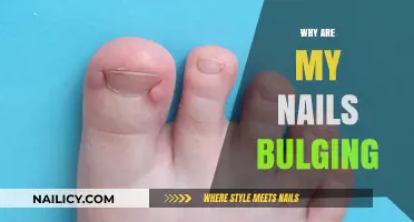 Why Are My Nails Bulging? Causes, Concerns, and Solutions Explained