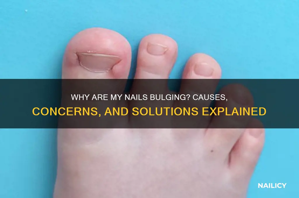 why are my nails bulging