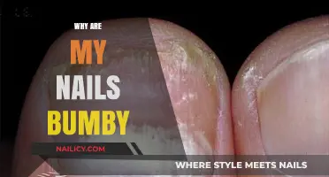 Bumpy Nails: Causes, Concerns, and Solutions for Smooth Nail Health