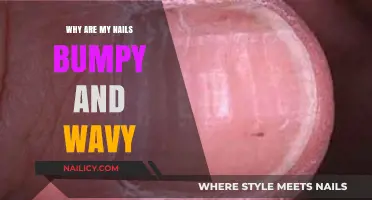 Bumpy and Wavy Nails: Causes, Concerns, and Solutions Explained