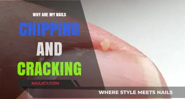 Why Are My Nails Chipping and Cracking? Causes and Solutions