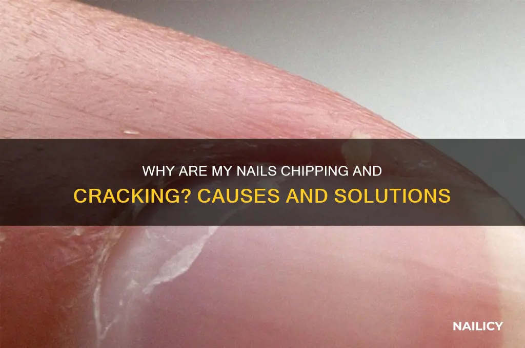 why are my nails chipping and cracking