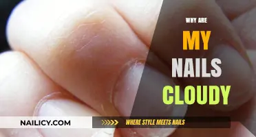 Why Are My Nails Cloudy? Causes and Solutions Explained