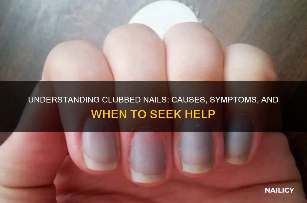 why are my nails clubbing
