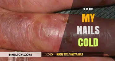 Cold Nails Explained: Causes and Solutions for Chilly Fingertips