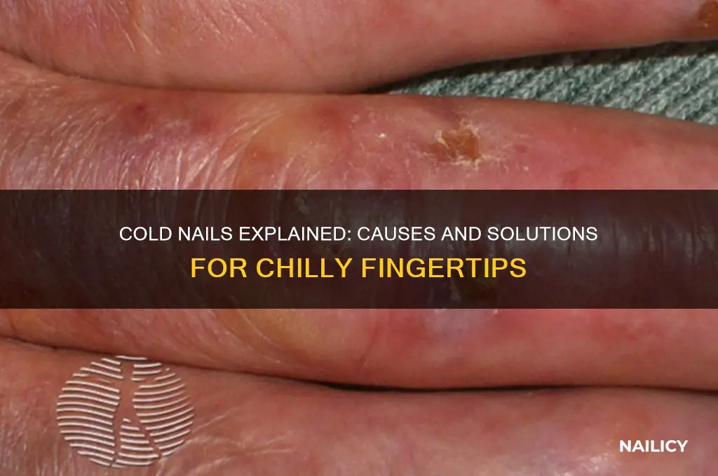 why are my nails cold