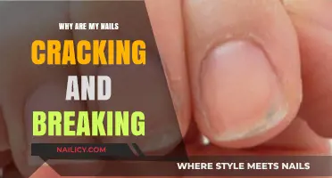 Why Are My Nails Cracking? Causes and Solutions for Brittle Nails