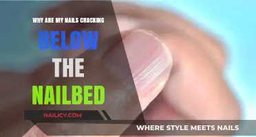 Why Are My Nails Cracking Below the Nailbed? Causes and Solutions