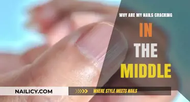 Why Are My Nails Cracking in the Middle? Causes and Solutions