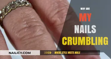 Why Are My Nails Crumbling? Causes and Solutions for Brittle Nails