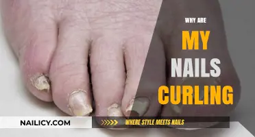Why Are My Nails Curling? Causes, Solutions, and Prevention Tips