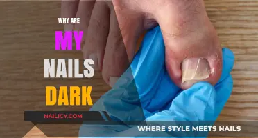 Why Are My Nails Dark? Causes and Solutions Explained