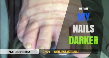 Why Are My Nails Darker? Causes and Solutions Explained
