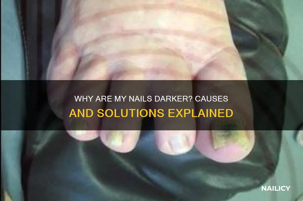 why are my nails darker