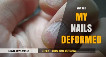 Understanding Nail Deformities: Causes, Prevention, and Treatment Options