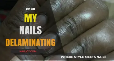 Why Are My Nails Delaminating? Causes and Solutions Explained