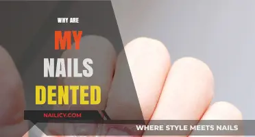 Dented Nails Explained: Causes, Prevention, and Treatment Solutions