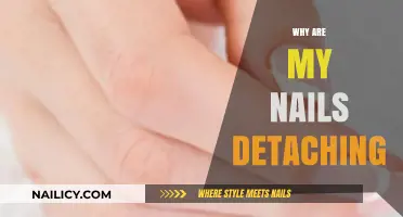 Why Are My Nails Detaching? Causes and Solutions Explained