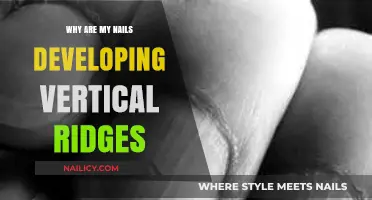 Understanding Vertical Nail Ridges: Causes and Solutions for Healthy Nails